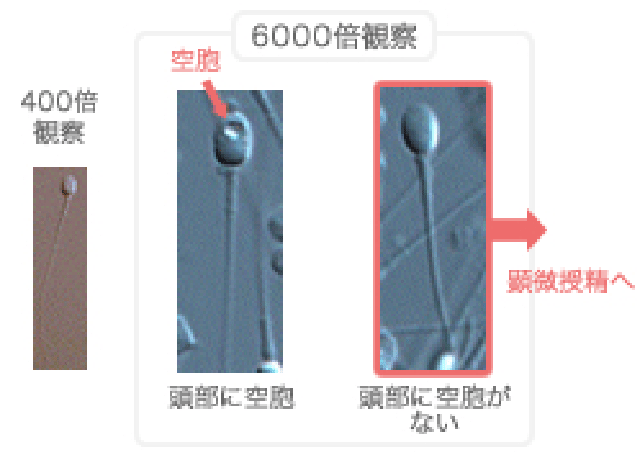 IMSI（イムジー）