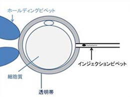 Piezo-ICSI