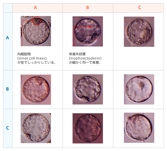 胚 盤 胞 に ならない 改善