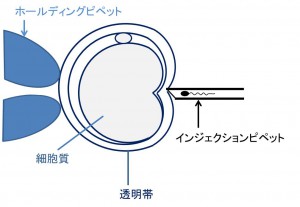 図1.c-ICSI透明体穿刺